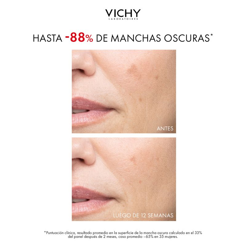 VICHY_PIGMENT-SPECIALIST-B3_PACK-ECOMM_IMG-SUPLEMENTARIAS_CREMA_03