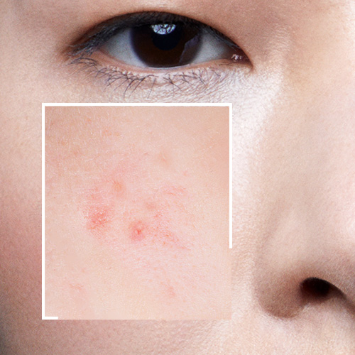 Productos La Roche-Posay para piel grasa y con tendencia acneica en Farmaplus